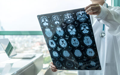 How Can I File a Claim for a Car Accident Brain Injury?